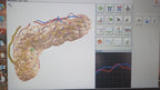 Hunter Bio-Resonance NLS